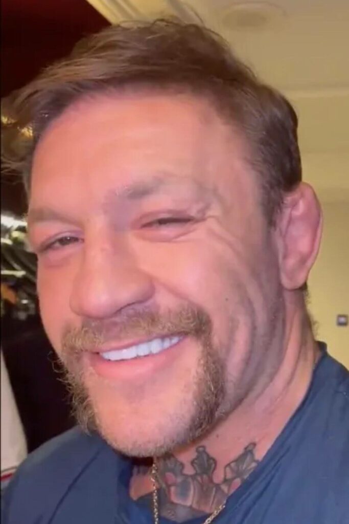 Conor McGregor Horseshoe Beard