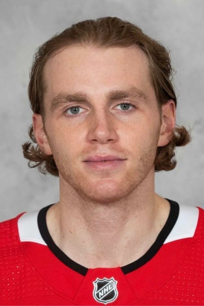 Patrick Kane Mullet front view