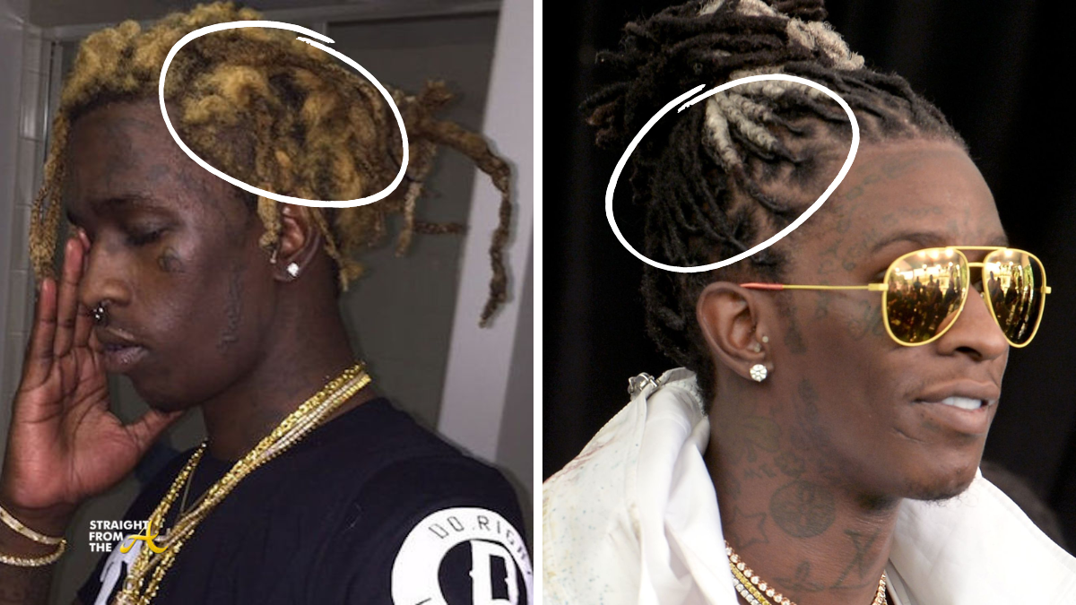 reattached dreads